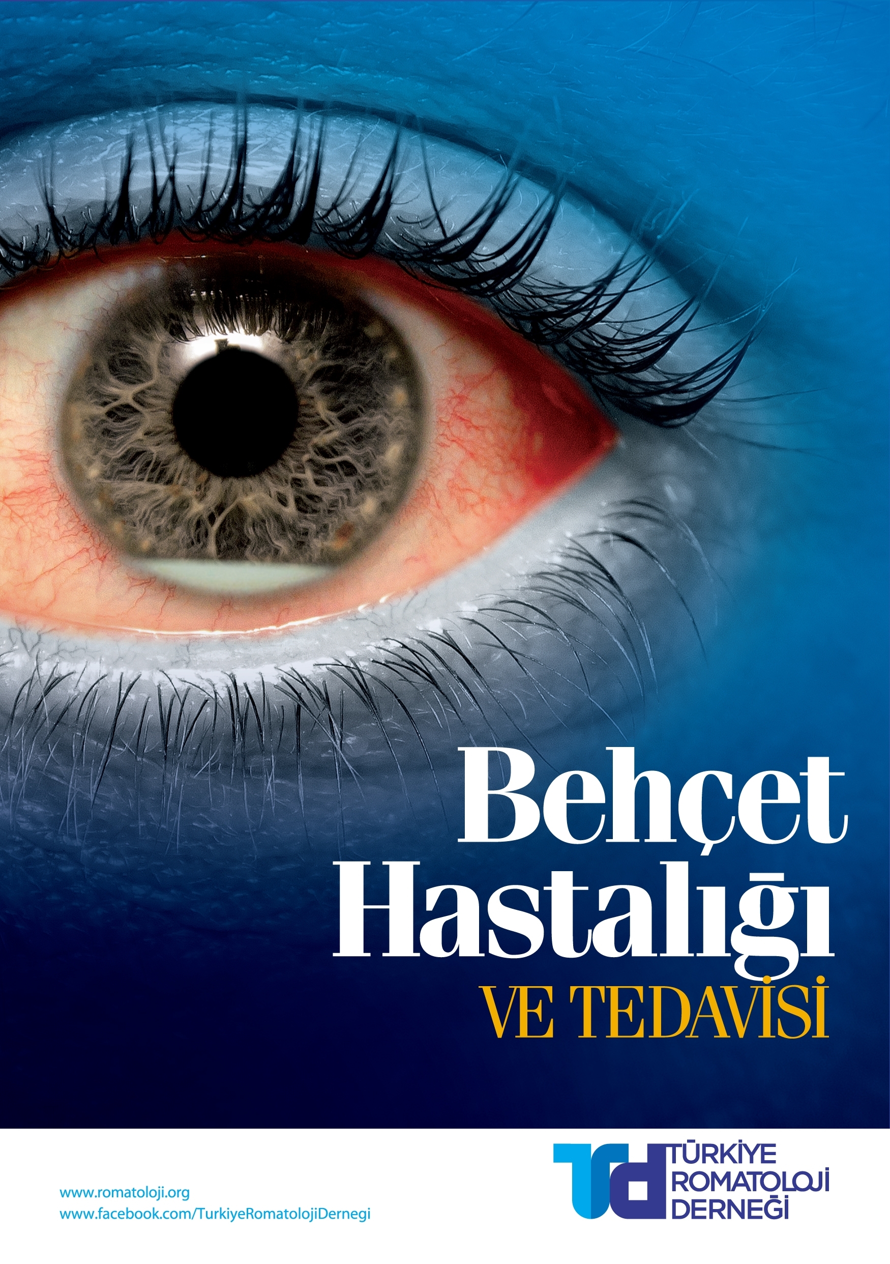 Behçet Hastalığı ve Tedavisi